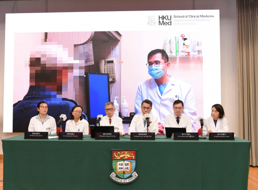 HKUMed takes the lead in adopting CAR-T cell therapy to treat a multiple myeloma patient, the first case in Hong Kong. Pictured (from left) Dr Karen Tang Hoi-ki, Dr Joycelyn Sim Pui-yin, Professor Kwong Yok-lam, Professor Eric Tse Wai-choi, Dr Thomas Chan Sau-yan and Dr Gloria Hwang Yu-yan.
 